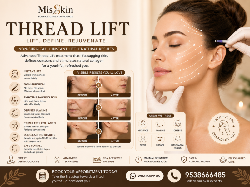Thread Lift in Bangalore treatment at Misskin