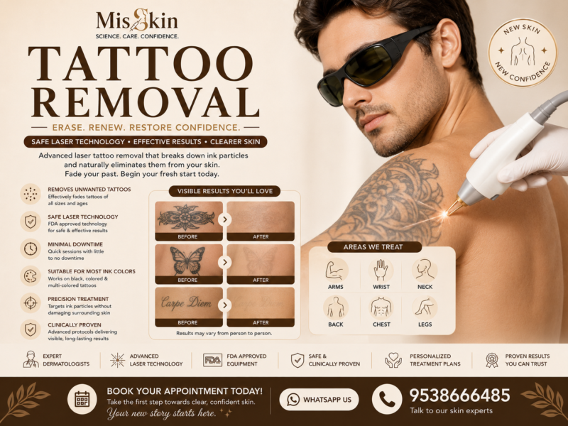 Tattoo Removal in Bangalore treatment at Misskin